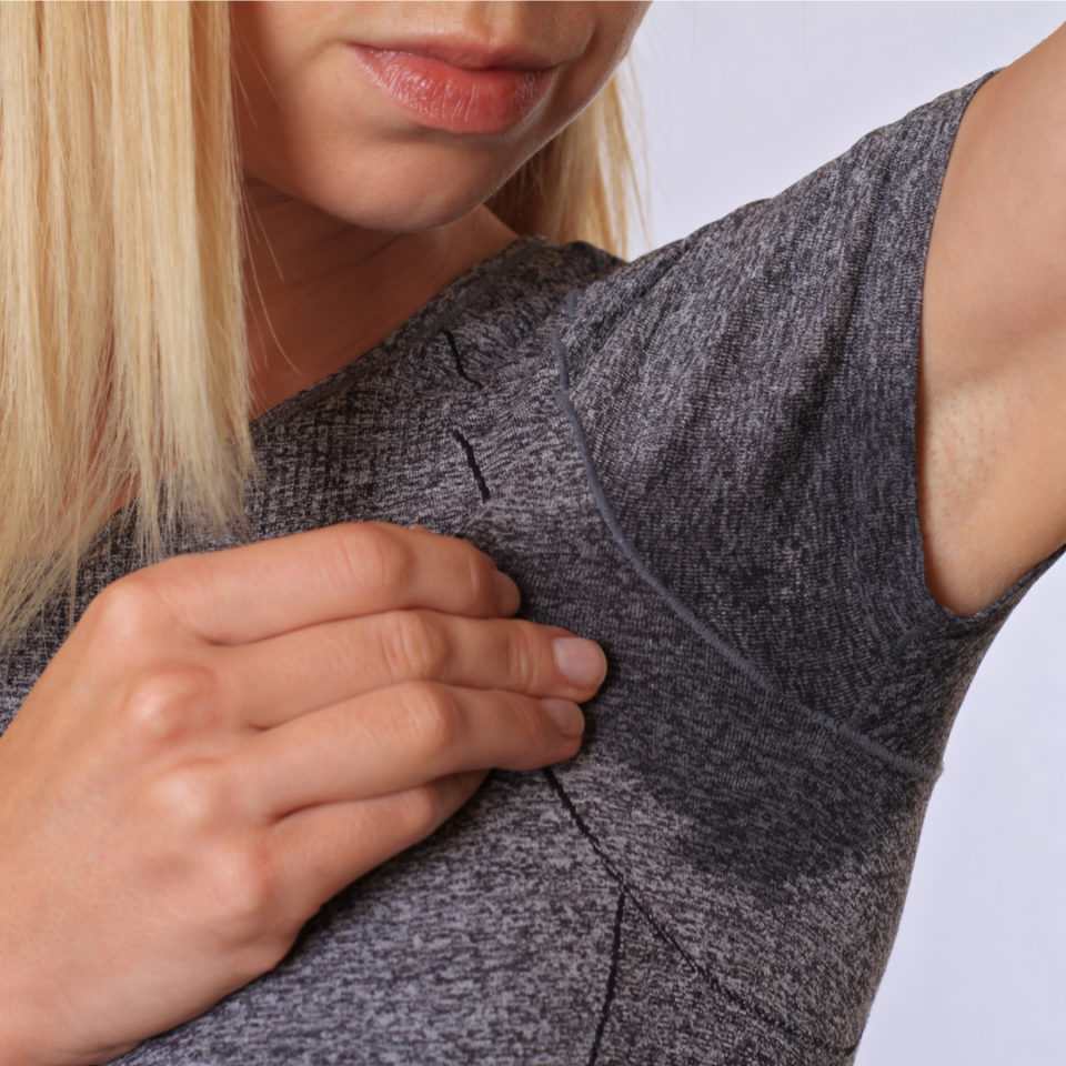 photo of hyperhydrosis