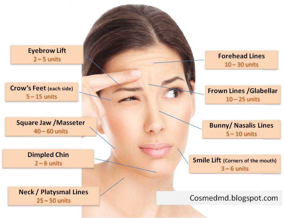 botox graphic