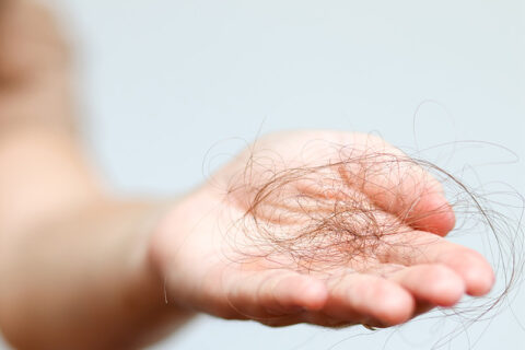 Hair fall on hand.