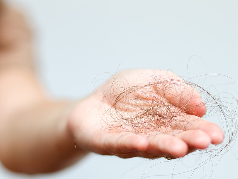 Hair fall on hand.