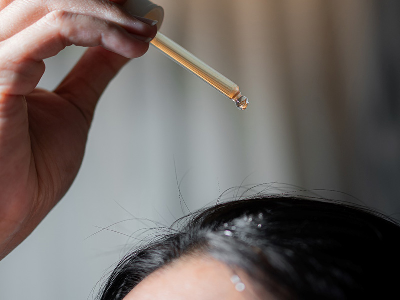 A hand holds a glass dropper dispensing liquid onto the scalp