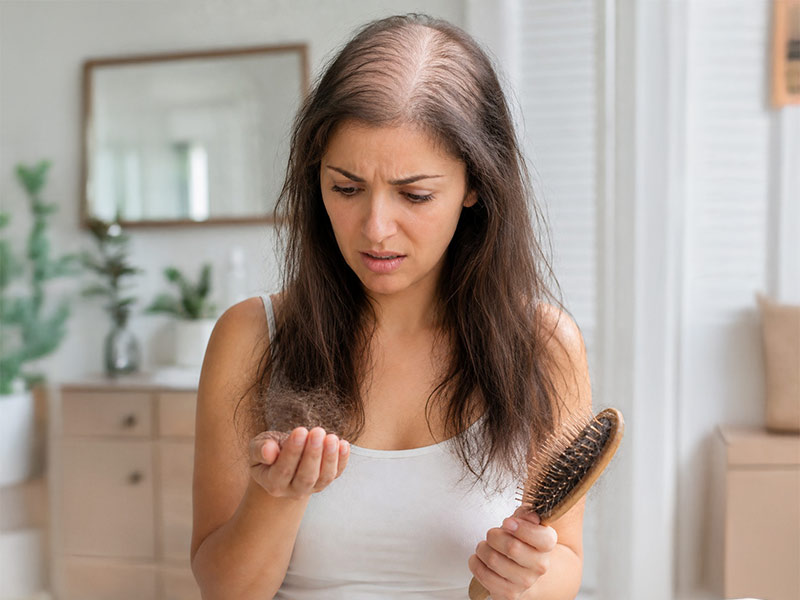 Beautiful young woman with problem of hairloss
